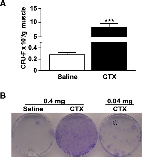 Muscle injury-induced hypoxia alters the proliferation and differentiation potentials of muscle resident stromal cells.