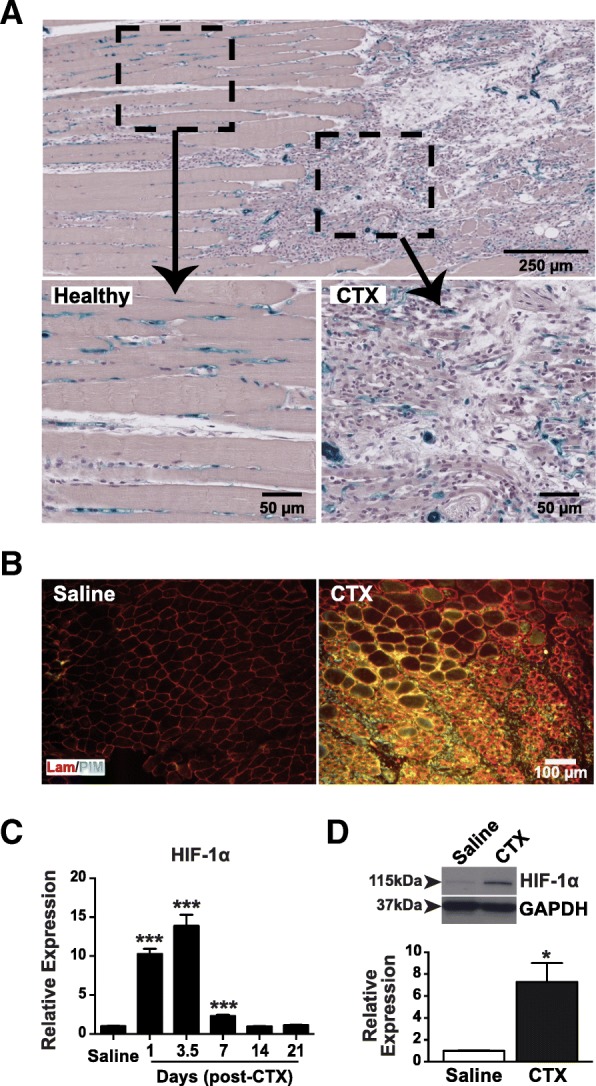 Muscle injury-induced hypoxia alters the proliferation and differentiation potentials of muscle resident stromal cells.