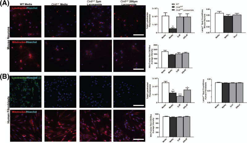 Modulation of CRMP2 via (<i>S</i>)-Lacosamide shows therapeutic promise but is ultimately ineffective in a mouse model of CLN6-Batten disease.