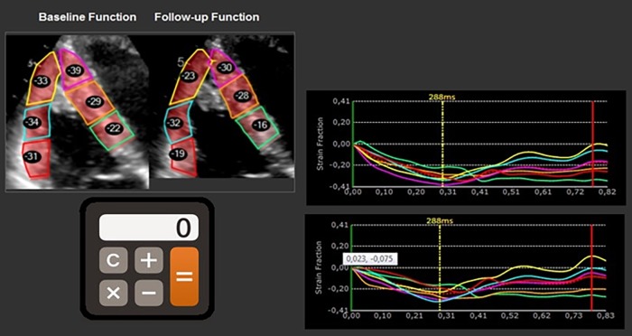 Longitudinal strain analysis allows the identification of subclinical deterioration of right ventricular function in patients with cancer therapy-related left ventricular dysfunction.