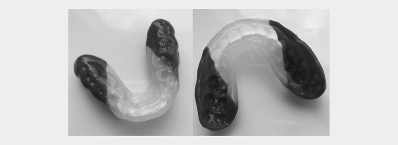 Influence of Mouthguards on Physiological Responses in Rugby.