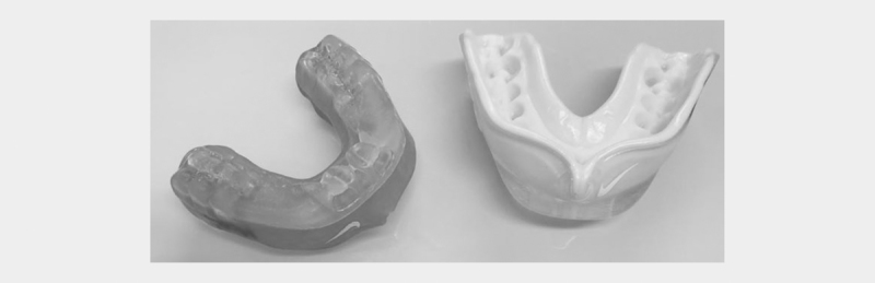 Influence of Mouthguards on Physiological Responses in Rugby.