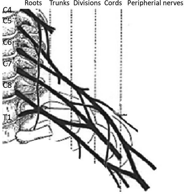 Evaluation of Brachial Plexus Using Combined Stereological Techniques of Diffusion Tensor Imaging and Fiber Tracking.