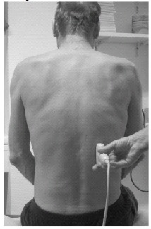Sonographically Measured Improvement in Diaphragmatic Mobility and Outcomes Among Patients Requiring Prolonged Weaning from the Ventilator.