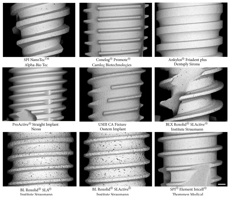 Al<sub>2</sub>O<sub>3</sub> Particles on Titanium Dental Implant Systems following Sandblasting and Acid-Etching Process.