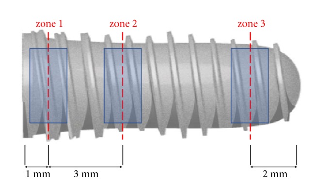 Al<sub>2</sub>O<sub>3</sub> Particles on Titanium Dental Implant Systems following Sandblasting and Acid-Etching Process.