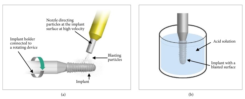 Al<sub>2</sub>O<sub>3</sub> Particles on Titanium Dental Implant Systems following Sandblasting and Acid-Etching Process.