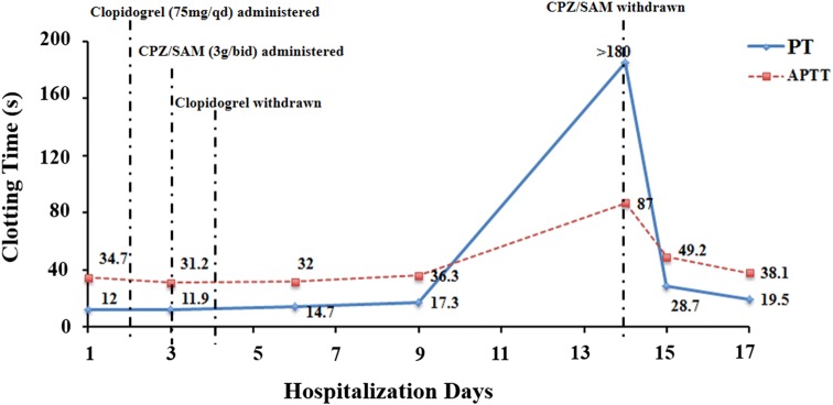 Fatal Vitamin K-Dependent Coagulopathy Associated with Cefoperazone/Sulbactam: A Case Report.