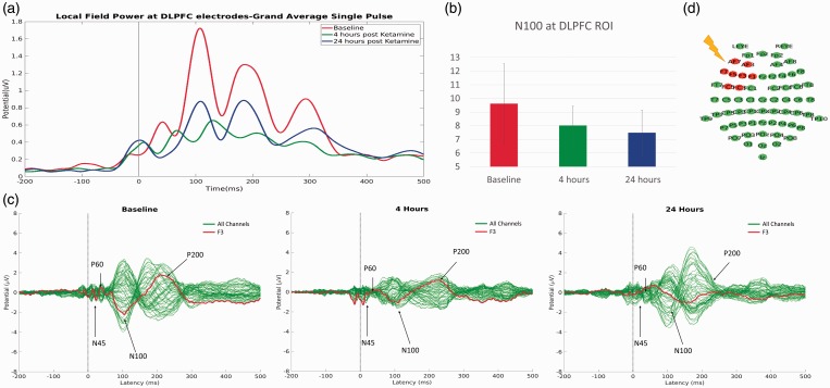 Neurophysiological Effect of Ketamine on Prefrontal Cortex in Treatment-Resistant Depression: A Combined Transcranial Magnetic Stimulation-Electroencephalography Study.