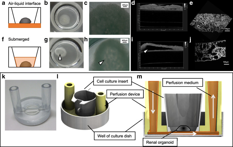 Perfusion culture maintained with an air-liquid interface to stimulate epithelial cell organization in renal organoids in vitro.