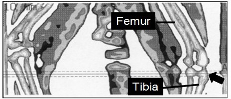 Effect of ovariectomy on proximal tibia metaphysis and lumbar vertebral body in common marmoset monkeys.