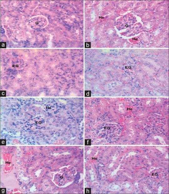 Investigating the Comparative Effects of Six Artemisinin-based Combination Therapies on <i>Plasmodium</i>-induced Hepatorenal Toxicity.