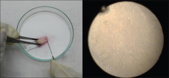 An <i>in vitro</i> evaluation of cytotoxicity of curcumin against human periodontal ligament fibroblasts.