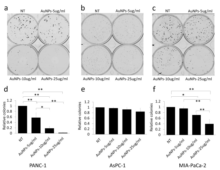 Gold Nanoparticles sensitize pancreatic cancer cells to gemcitabine.