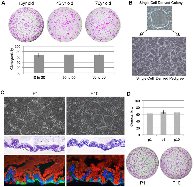 Unlimited expansion of intestinal stem cells from a wide range of ages.