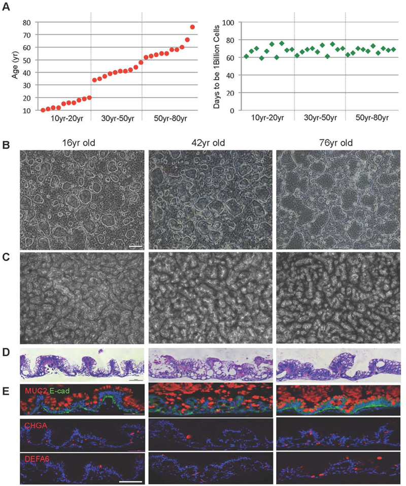 Unlimited expansion of intestinal stem cells from a wide range of ages.