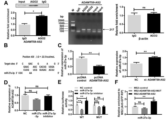 LncRNA ADAMTS9-AS2 inhibits cell proliferation and decreases chemoresistance in clear cell renal cell carcinoma via the miR-27a-3p/FOXO1 axis.