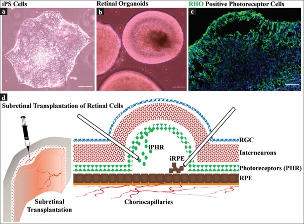 Induced pluripotent stem cells and derivative photoreceptor precursors as therapeutic cells for retinal degenerations.