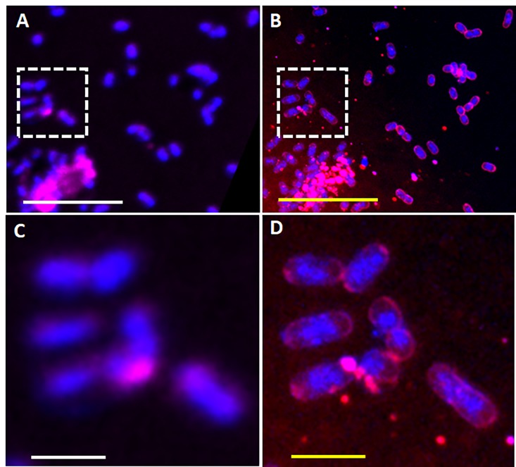 Nanoscale imaging of E. coli cells by expansion microscopy.