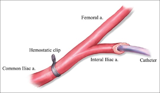 <i>In vivo</i> assessment of endothelial function in small animals using an infrared pulse detector.