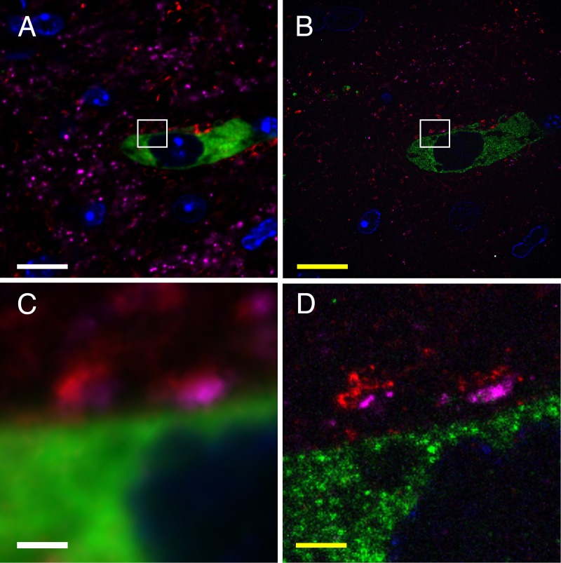 Nanoscale Imaging of Synaptic Connections with Expansion Microscopy.