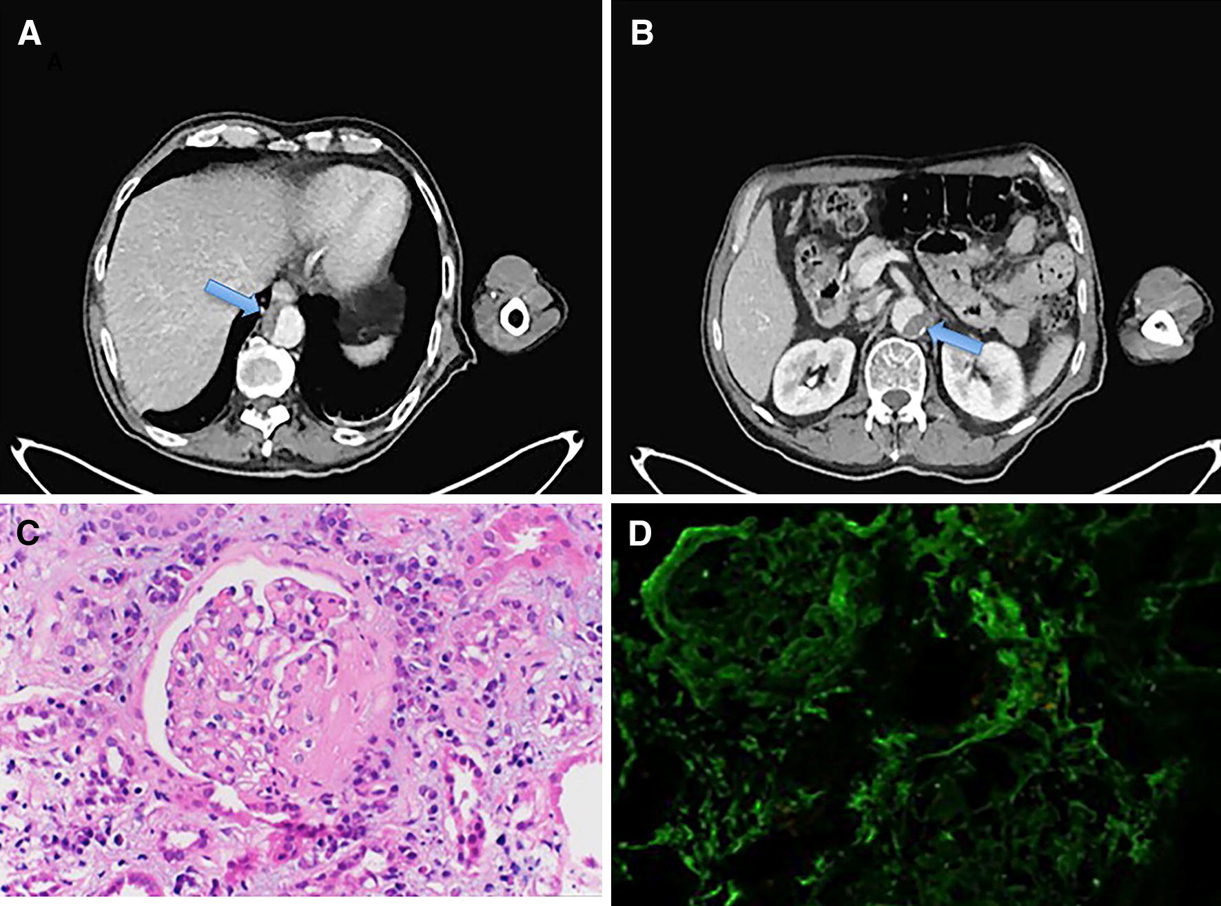 Look granulomatosis with polyangiitis (GPA) straight in the face: missed opportunities leading to a delayed diagnosis.