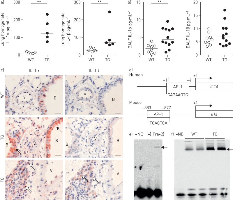 IL-1 receptor blockade skews inflammation towards Th2 in a mouse model of systemic sclerosis.