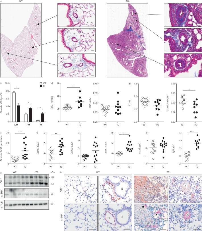 IL-1 receptor blockade skews inflammation towards Th2 in a mouse model of systemic sclerosis.