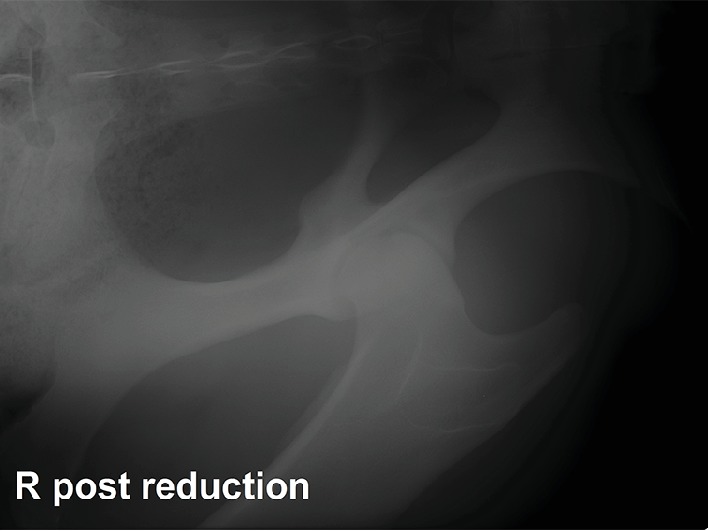 Successful Treatment of a Coxofemoral Luxation in a Shetland Pony by Closed Reduction and Prolonged Immobilization Using a Full-Body Animal Rescue Sling.