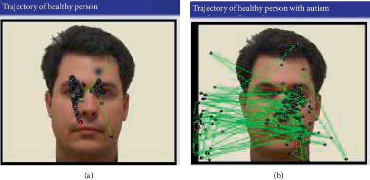 Data Analysis and Classification of Autism Spectrum Disorder Using Principal Component Analysis.