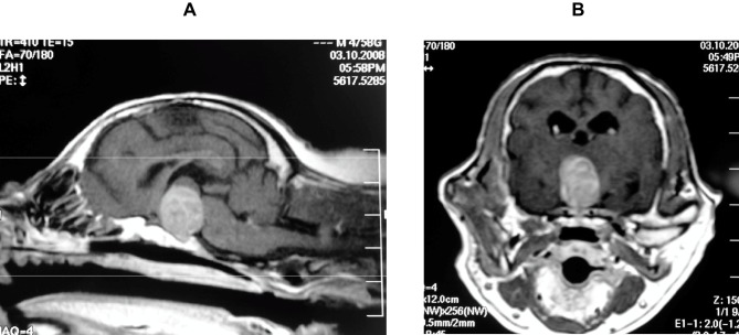 Transsphenoidal Surgery in Canines: Safety, Efficacy and Patient Selection.