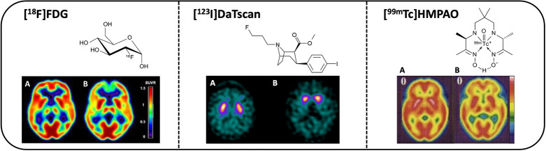 Radionuclide Imaging for Neuroscience: Current Opinion and Future Directions.