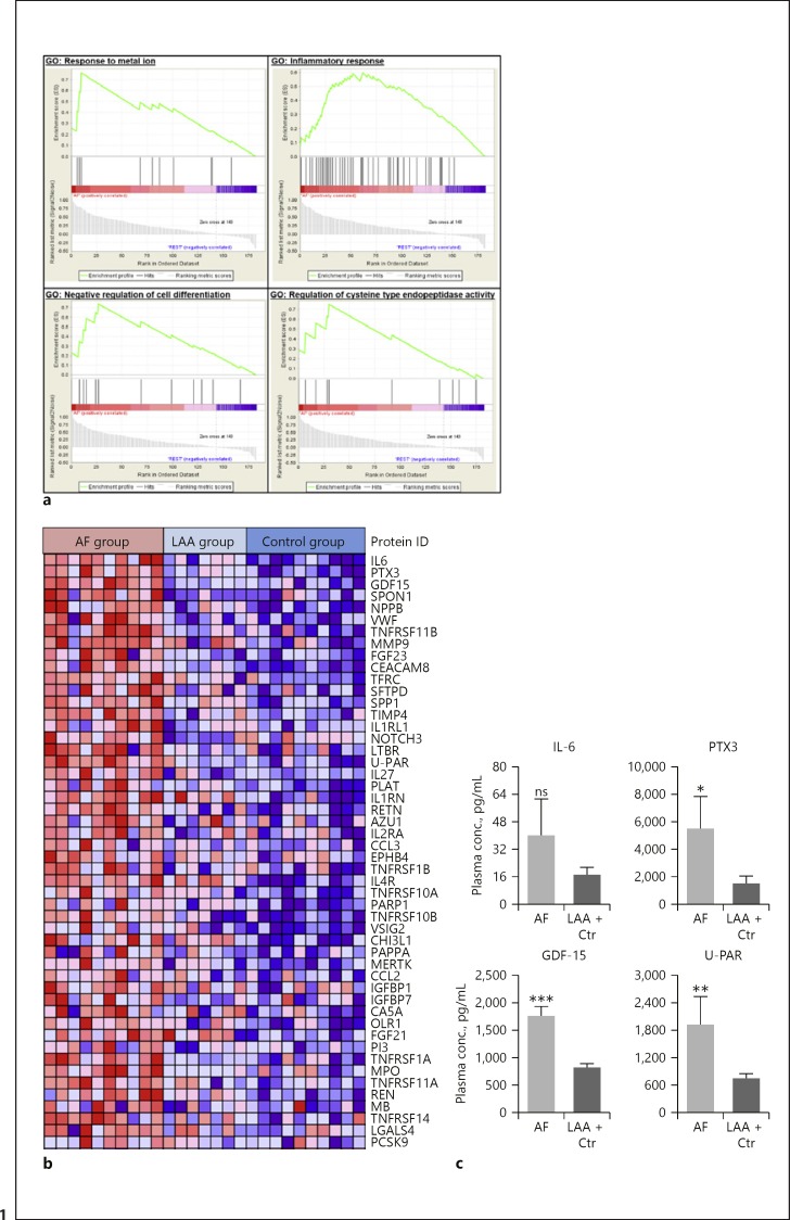 Biomarkers Associated with Atrial Fibrillation in Patients with Ischemic Stroke: A Pilot Study from the NOR-FIB Study.