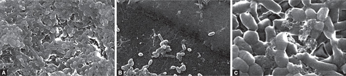 Antimicrobial and Antibiofilm Effect of Cranberry Extract on <i>Streptococcus mutans</i> and <i>Lactobacillus acidophilus</i>: An <i>In Vitro</i> Study.