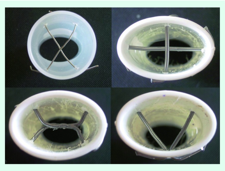 Inhaled chemotherapy adverse effects: mechanisms and protection methods.