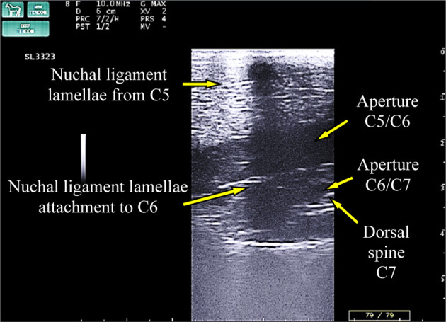 An <i>in situ</i> and ultrasound study of Yonaguni ponies revealed the rare finding of the nuchal ligament lamellae from C2-C7.