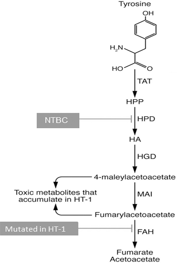 The future of gene-targeted therapy for hereditary tyrosinemia type 1 as a lead indication among the inborn errors of metabolism.