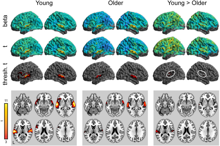 Age-Related Differences in Auditory Cortex Activity During Spoken Word Recognition.