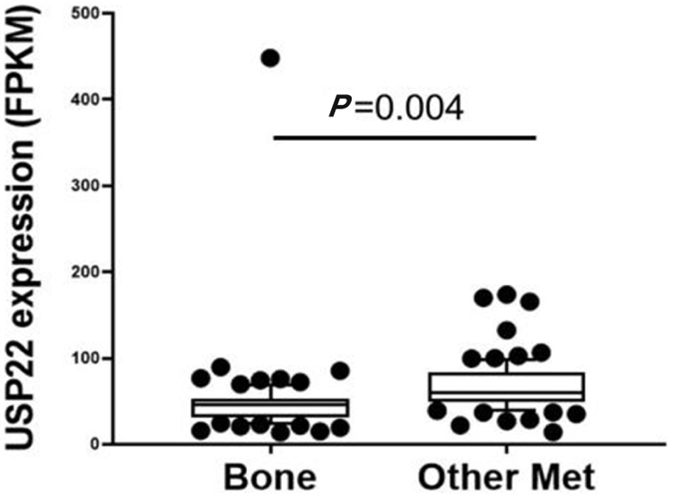 Deubiquitination in prostate cancer progression: role of USP22.