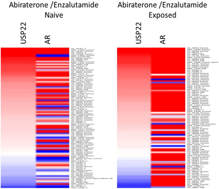 Deubiquitination in prostate cancer progression: role of USP22.