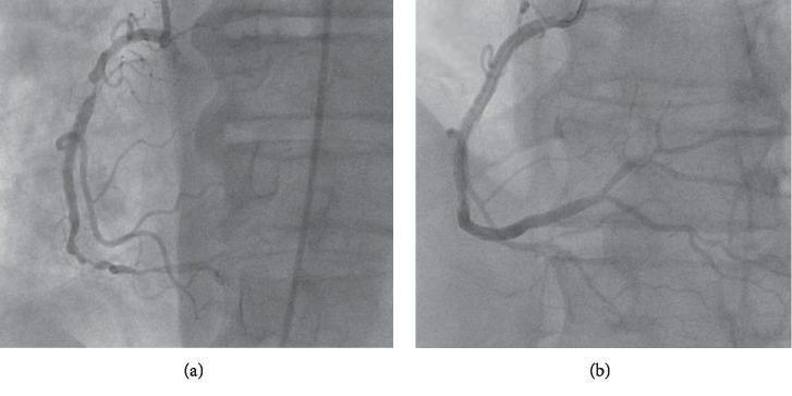 Successful Kidney Transplantation in a Recipient Coinfected with Hepatitis C Genotype 2 and HIV from a Donor Infected with Hepatitis C Genotype 1 in the Direct-Acting Antiviral Era.