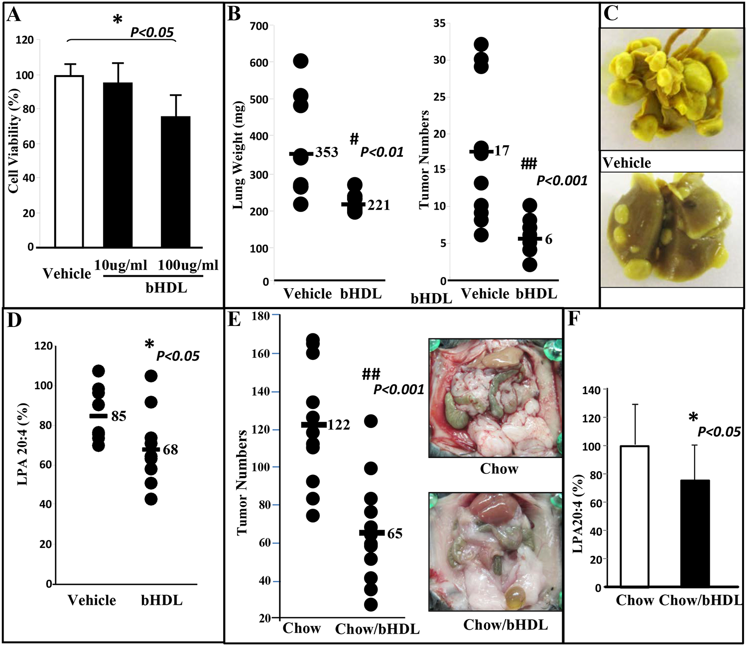 Bovine HDL and Dual Domain HDL-Mimetic Peptides Inhibit Tumor Development in Mice.