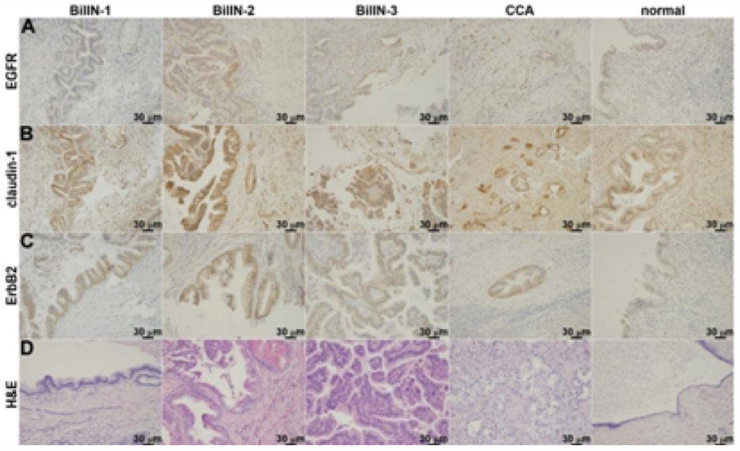 Multiplexed Imaging Strategy to Distinguish Indeterminant Biliary Strictures: An <i>Ex Vivo</i> Study.