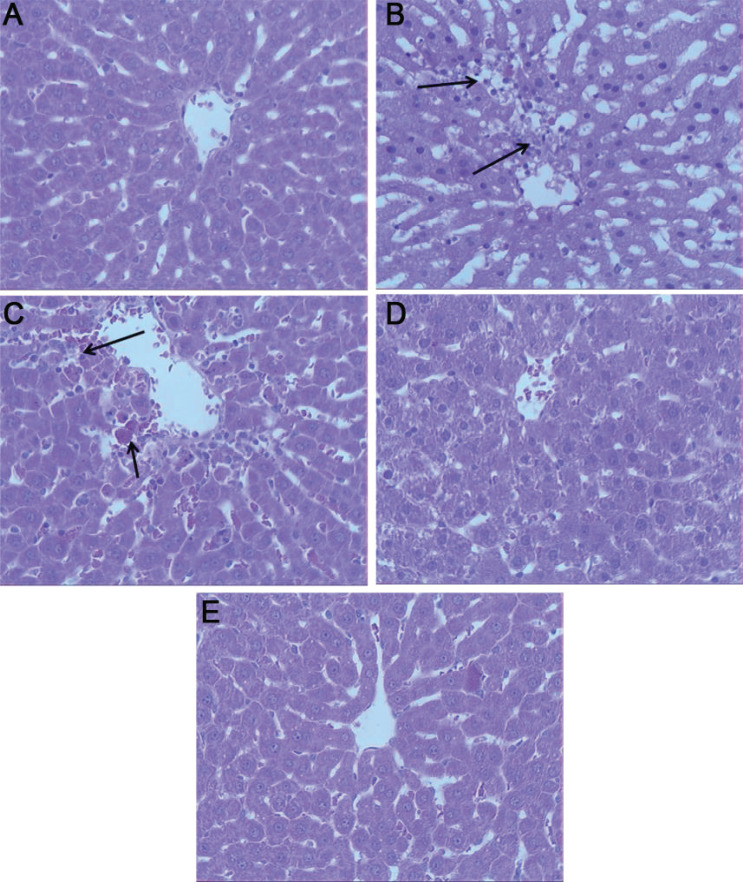 Anti-inflammatory and Antioxidant Effects of <i>Lotus corniculatus</i> on Paracetamol-induced Hepatitis in Rats.