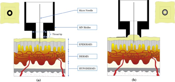 Parametric study of 3D printed microneedle (MN) holders for interstitial fluid (ISF) extraction.