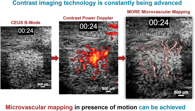 The 34th Annual Advances in Contrast Ultrasound International Bubble Conference, Chicago 2019: synopsis and take-home messages.