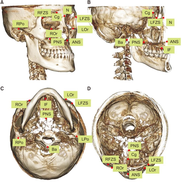 Comparison of three midsagittal planes for three-dimensional cone beam computed tomography head reorientation.