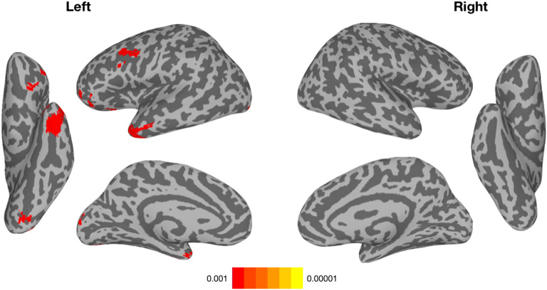 Neural Components of Reading Revealed by Distributed and Symbolic Computational Models.