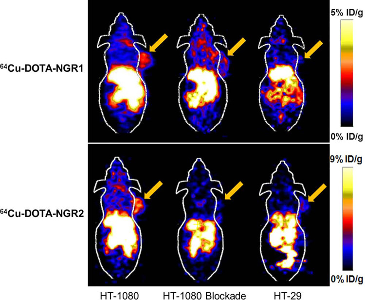 Research Progress of Radiolabeled Asn-Gly-Arg (NGR) Peptides for Imaging and Therapy.