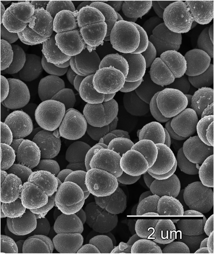 Lowering effect of viable <i>Pediococcus pentosaceus</i> QU 19 on the rise in postprandial glucose.